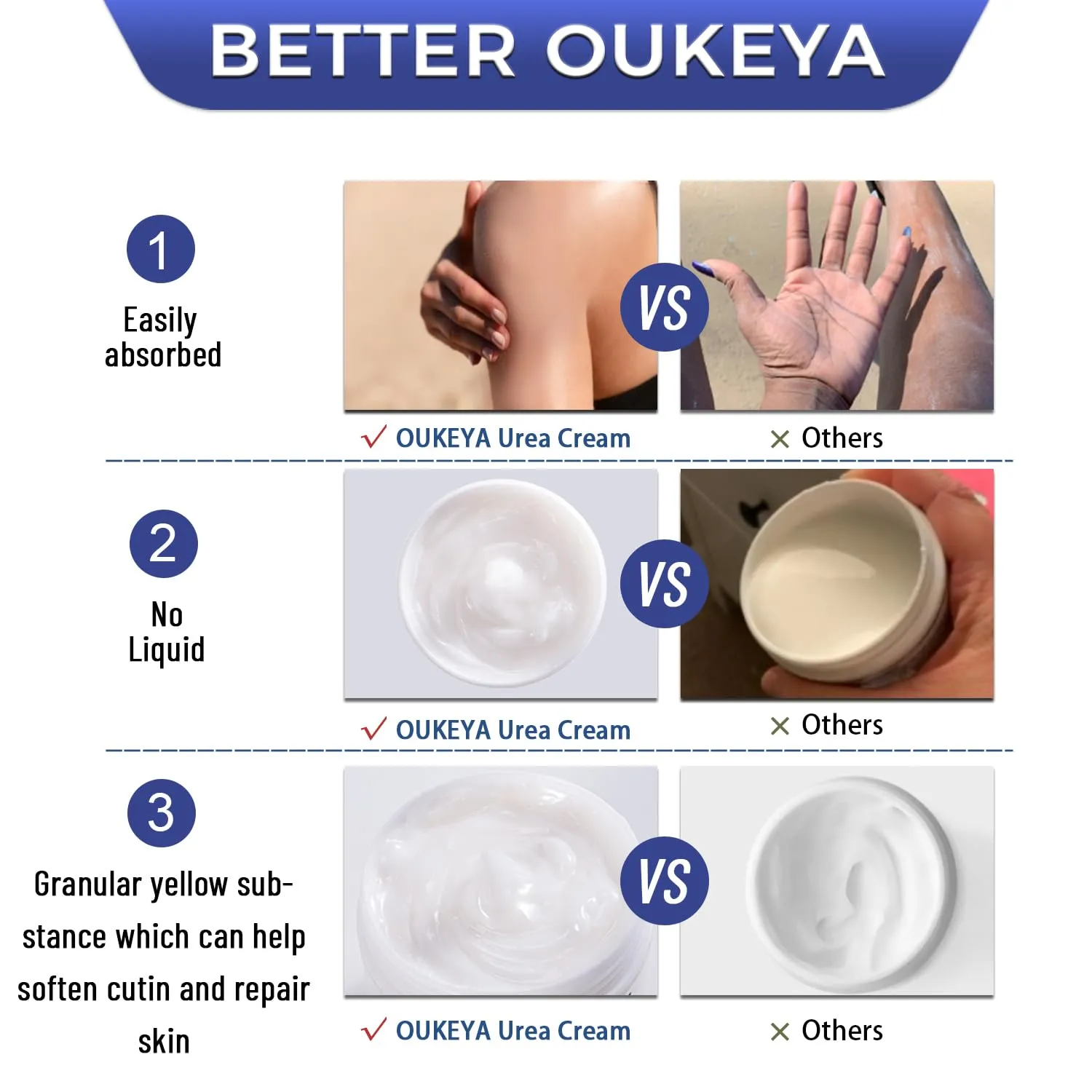 OUKEYA Urea Cream 42% plus Salicylic Acid 2% Intensive Repair Treatment for Cracked Skin on Hands, Heels, Elbows, and Lips - Relief for Dry Feet - Enhanced Pump Dispenser Packaging 2 Pack